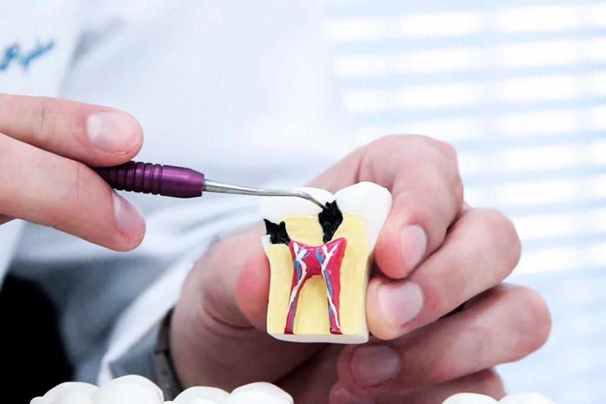 Endodontia Endodontia