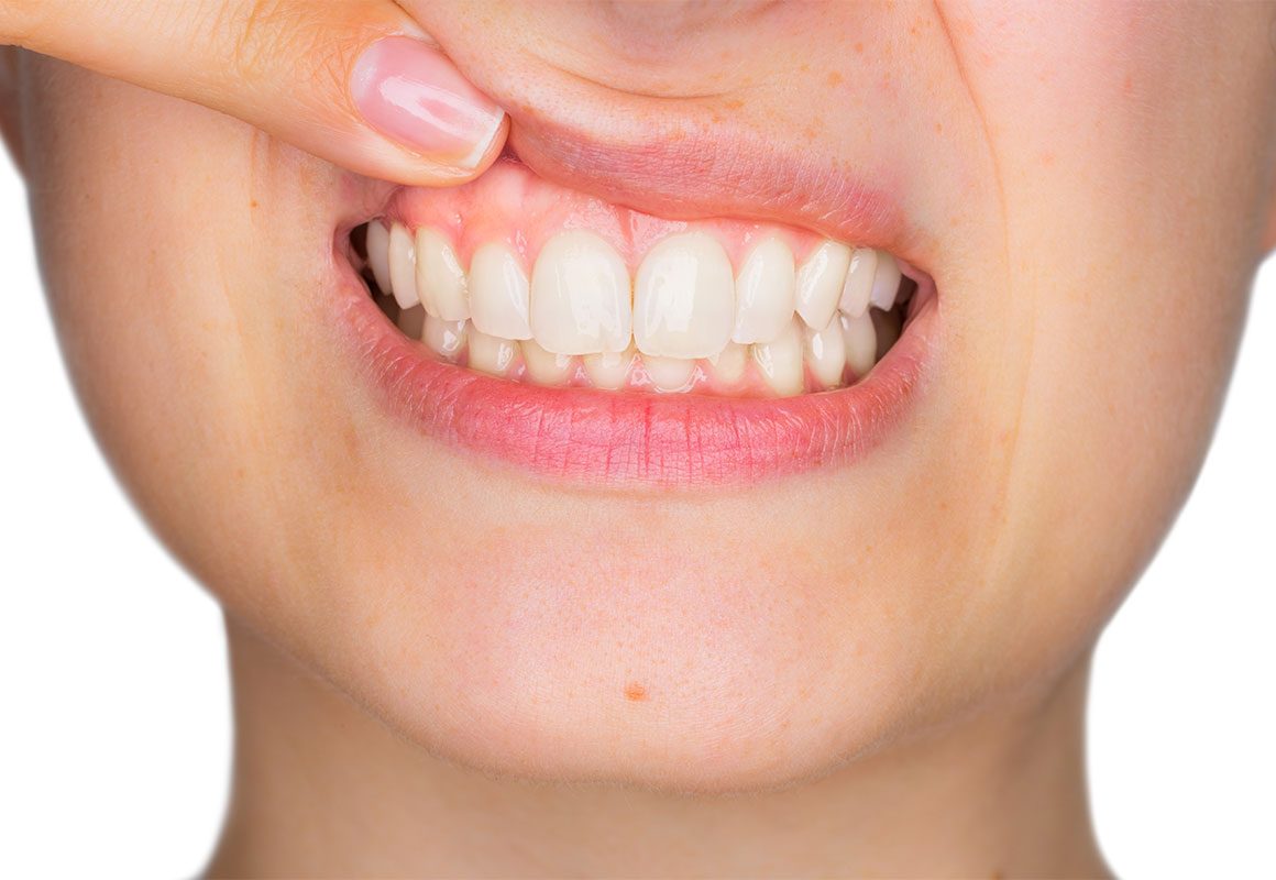 Periodontia